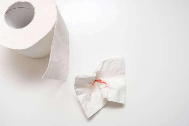 Rectal bleeding in a tissue paper