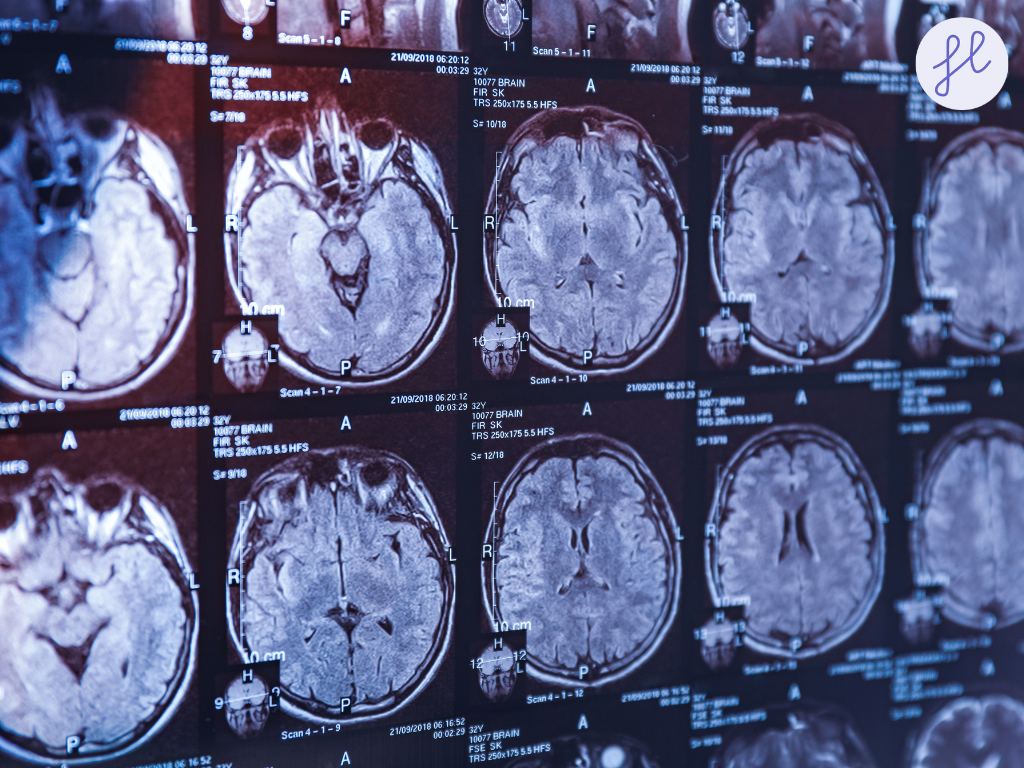 Expert Guide to Concussion Recovery