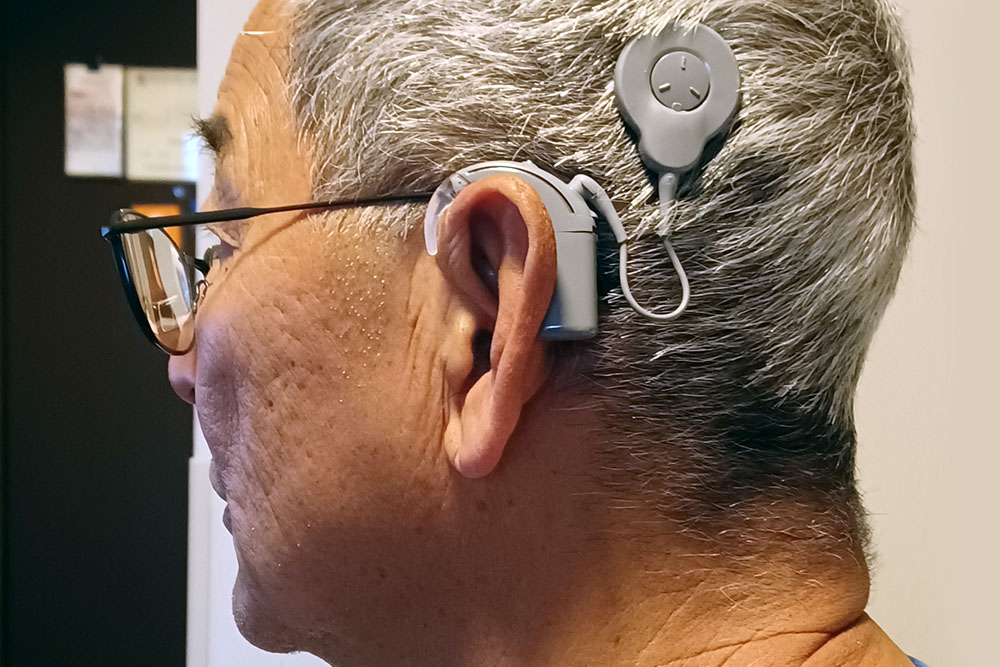 Cochlear Implant Use Lagging in Older Adults
