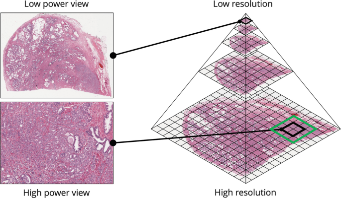 Whole Slide Imaging (WSI)